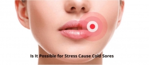Cold Sore - Causes Cold Sore - Causes